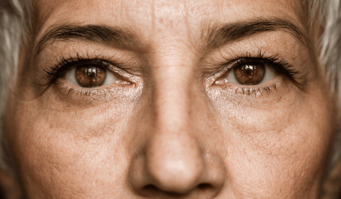Heavy Brow Treatments: What You Need To Know