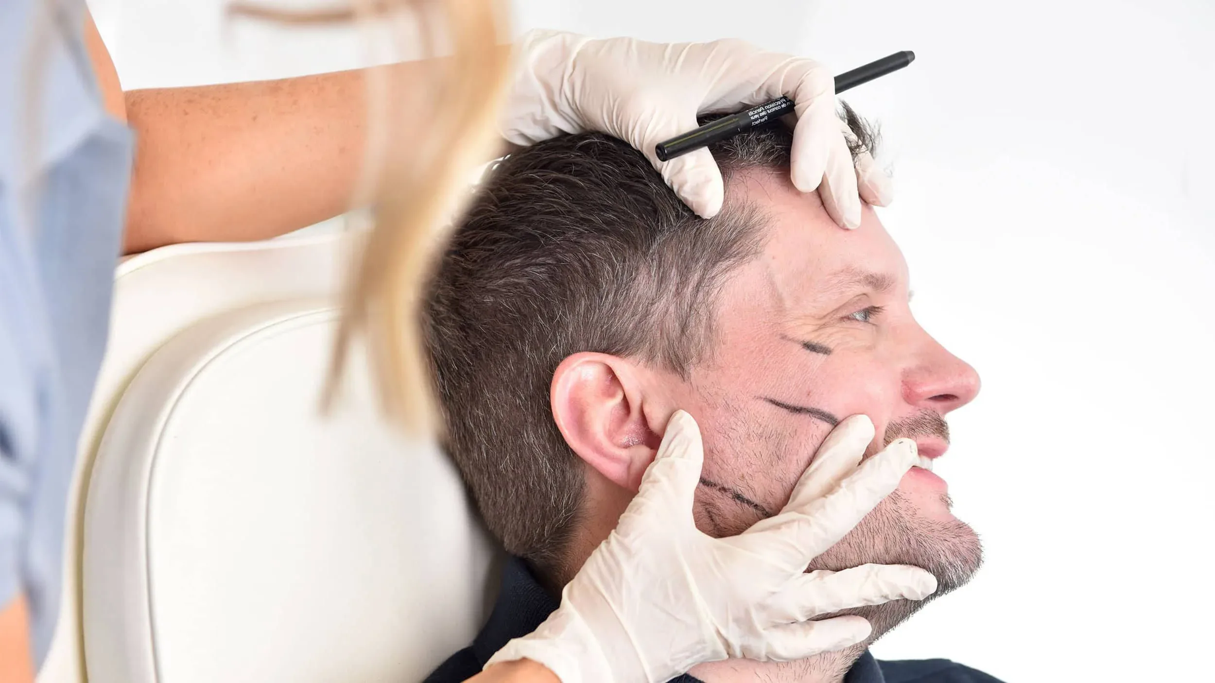 Dermal Fillers
