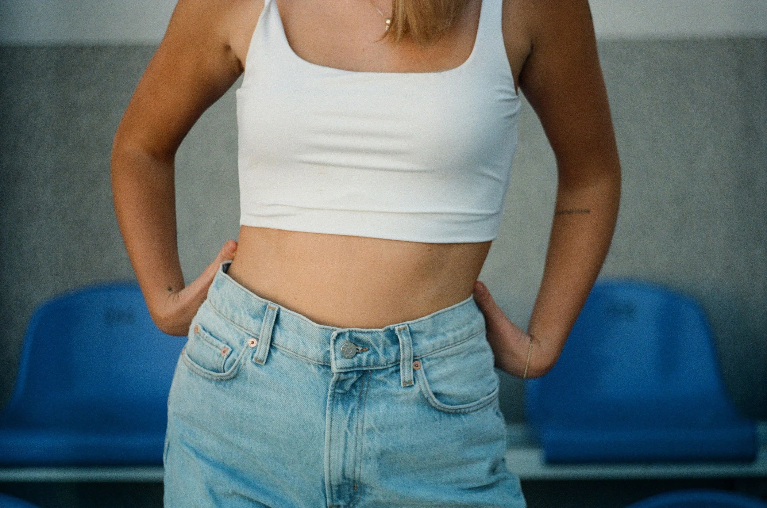 Abdominoplasty (Tummy Tuck)