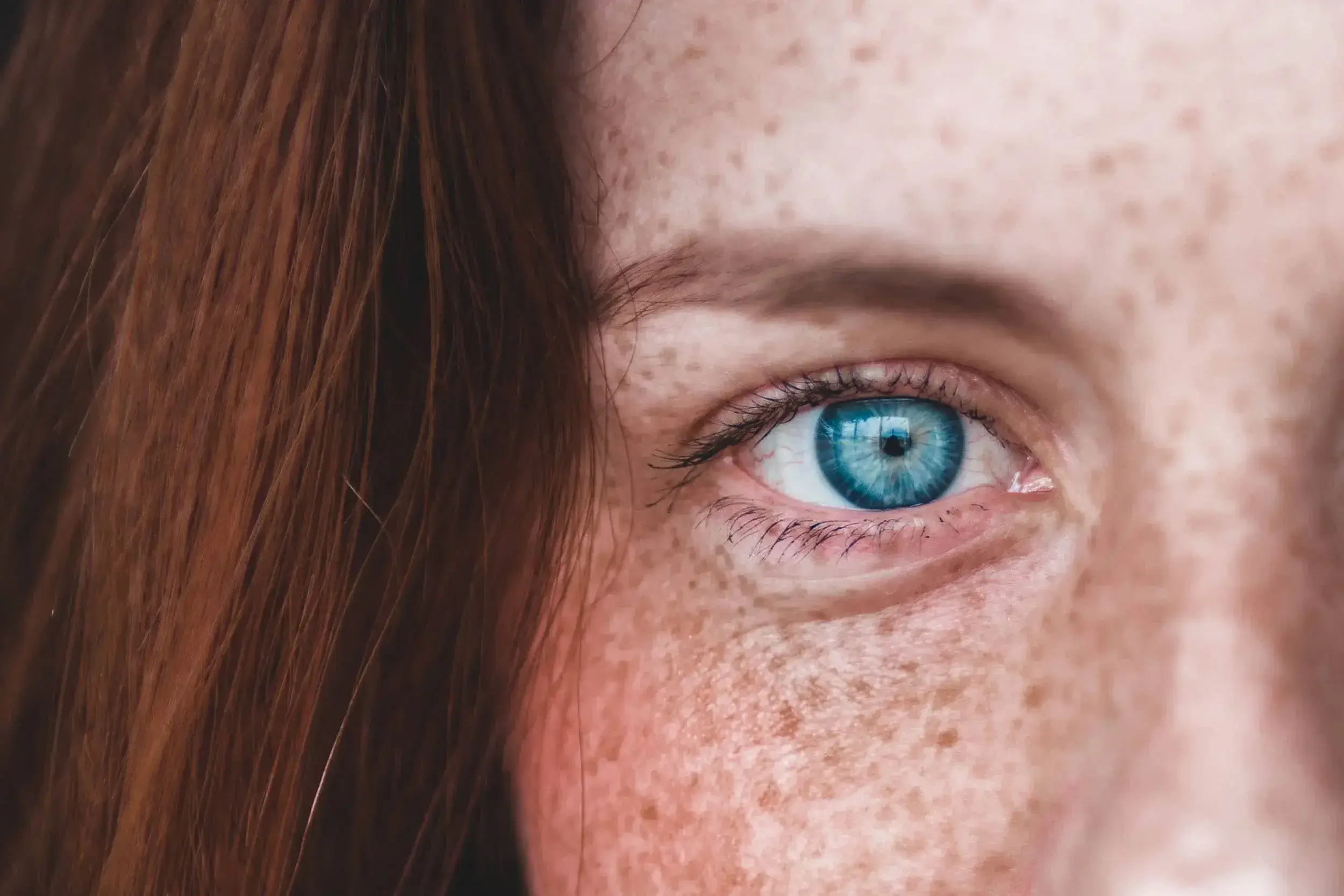 Close-up of a blue eye surrounded by freckled skin and brown hair.