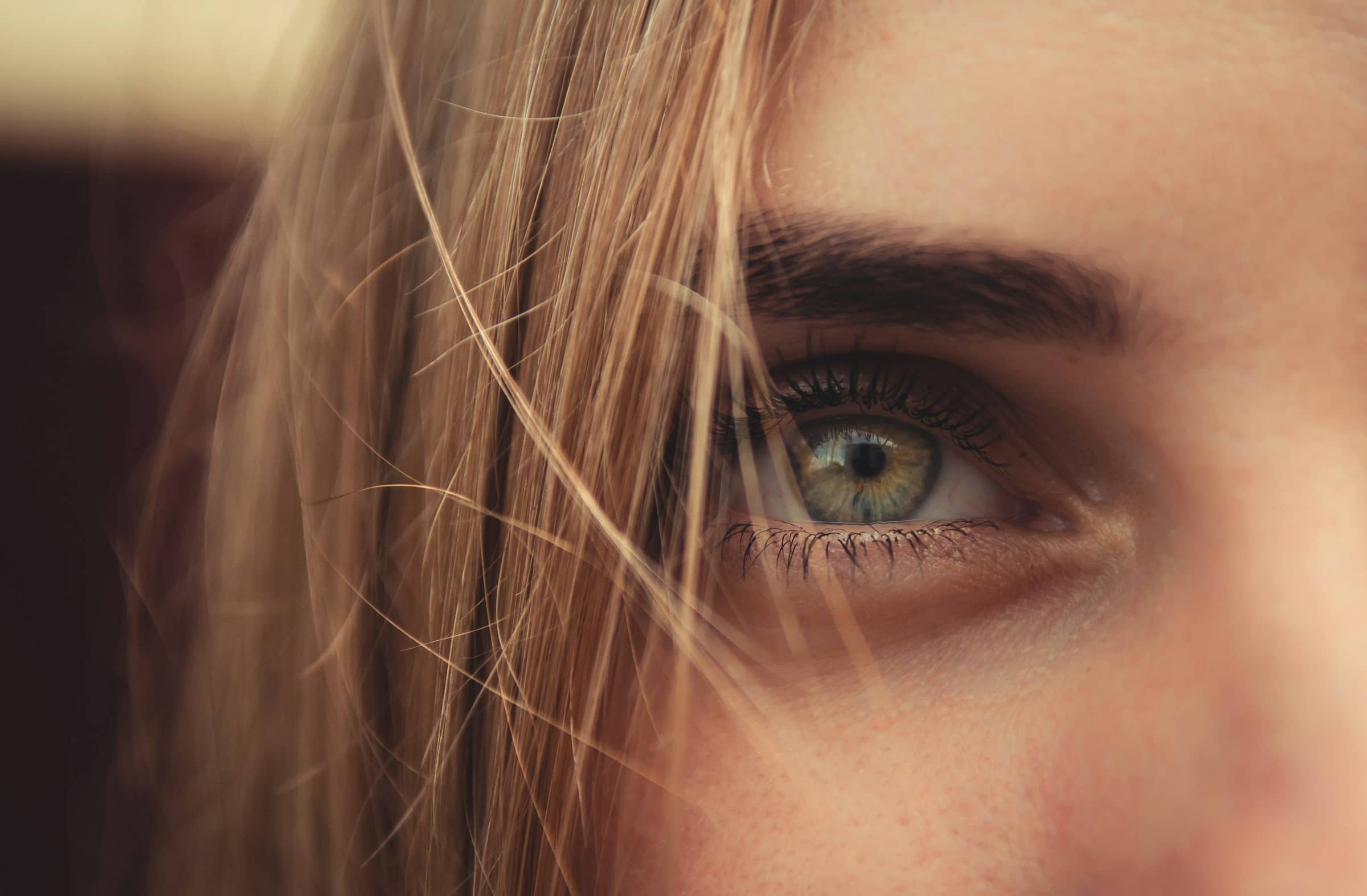 Upper Blepharoplasty