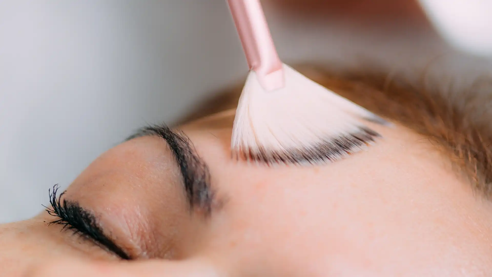 Chemical Peels Scotland
